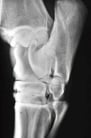 Osteoarthritis of the Distal Tarsal Joints in Horses