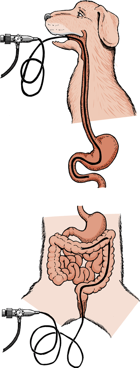 Examen del tracto digestivo con endoscopio.