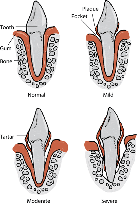 Progression of periodontal disease in dogs