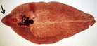 <i>Fasciola hepatica</i> in Ruminants