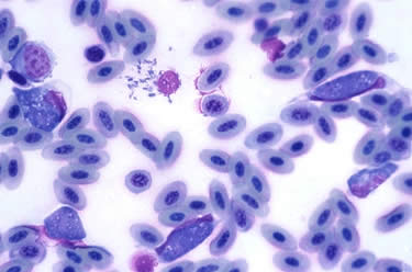 Leukocytozoon,