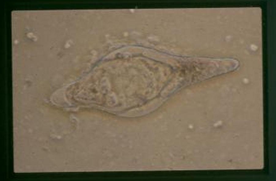 Schistosoma bovis egg
